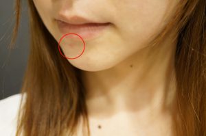 パルクレールジェル